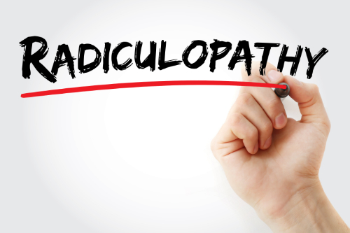 Radiculopathy