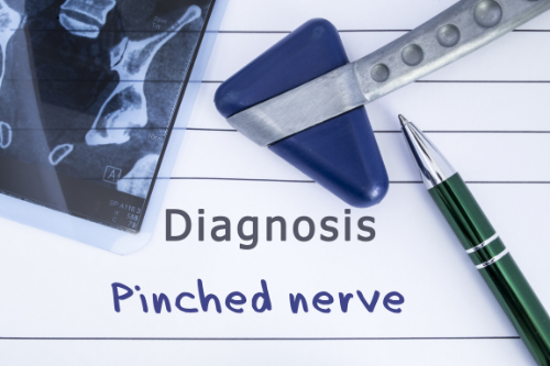 Why A Pinched Nerve Responds So Well To Chiropractic