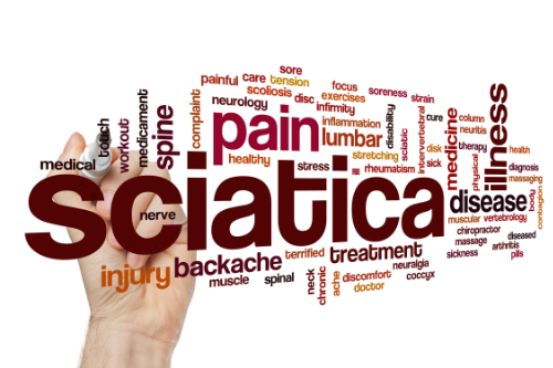 Sciatica – What Chiropractic Patients Want To Know