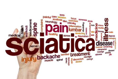 sciatica