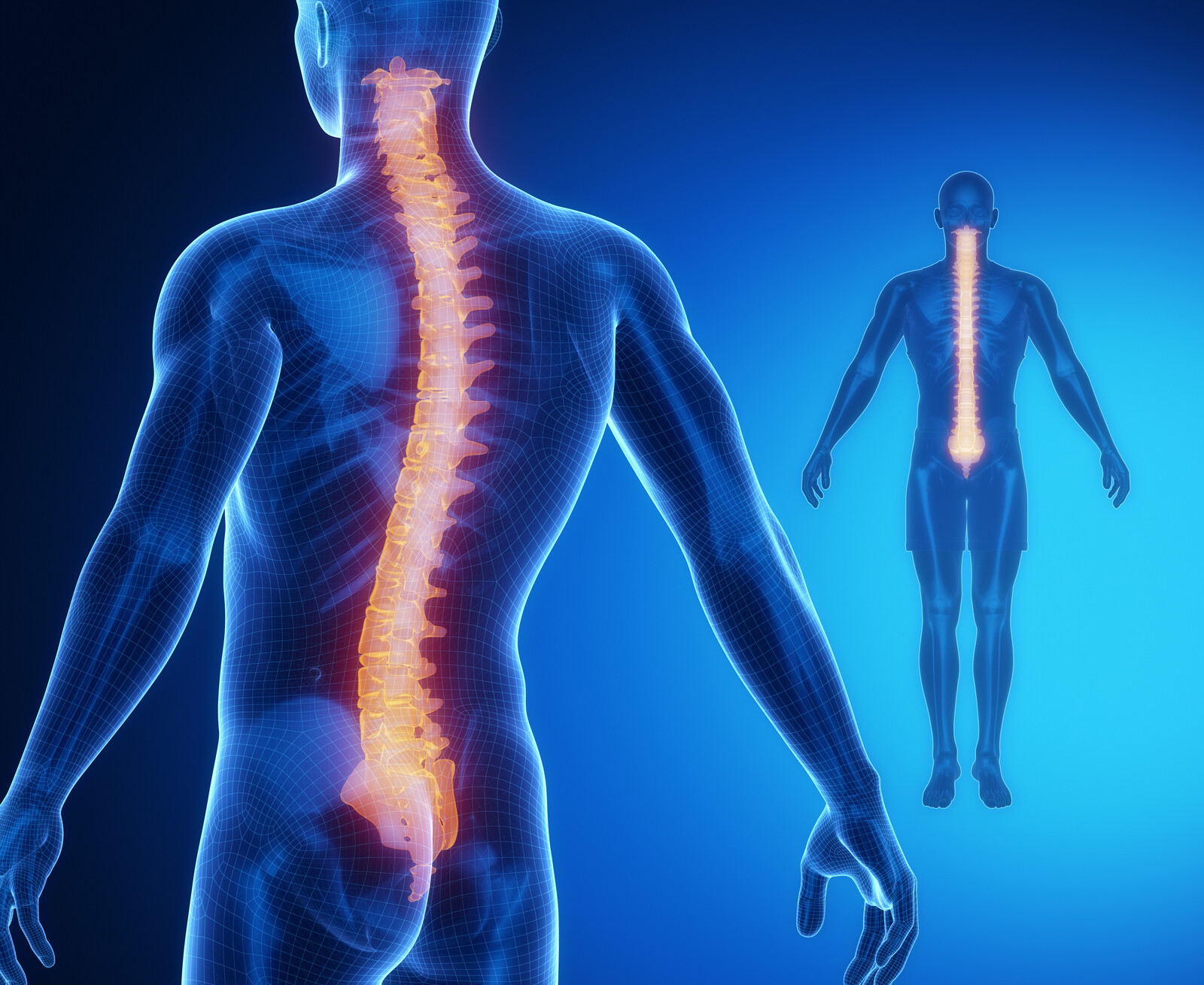 Understanding Whiplash